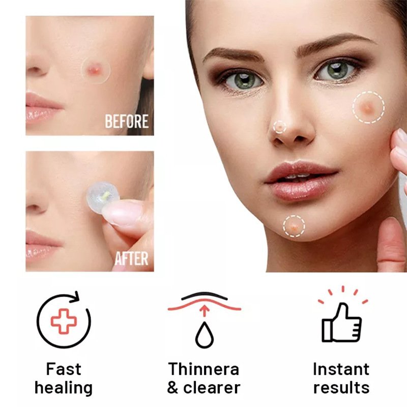 Before and after using Magical Patch