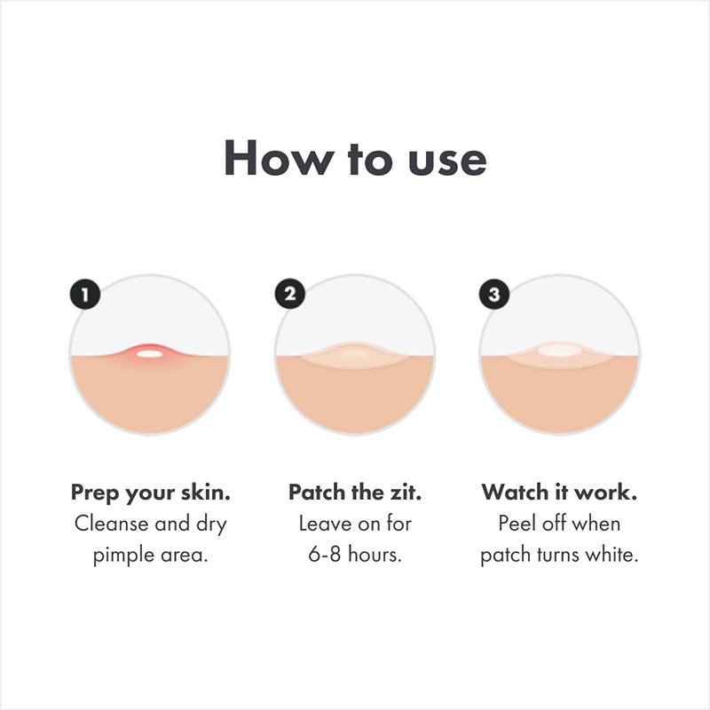 How to use Magical Patch